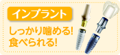 インプラント